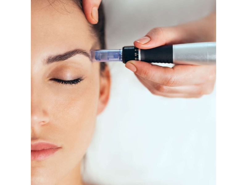 prp treatment for hair