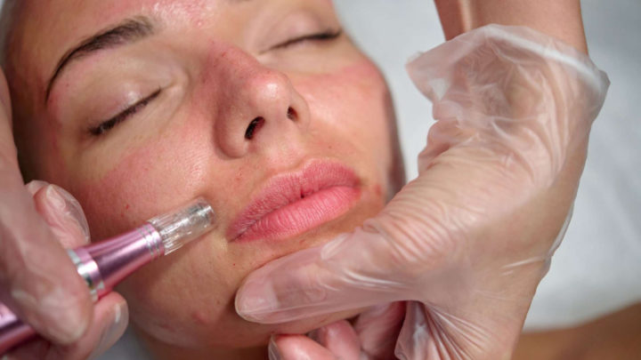 A Beginner’s Guide To PRP Treatment For Hair Health