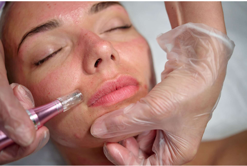 A Beginner’s Guide To PRP Treatment For Hair Health