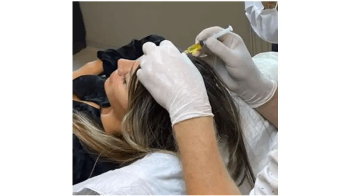 What To Expect From Hair Loss Women Treatment In Istanbul?