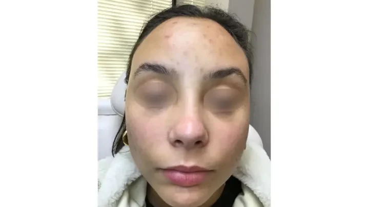 Why The Best Dermatologist In Austin Is Essential For Your Skin Health?