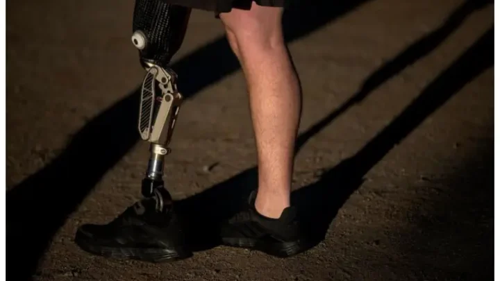 How Does Robotic Knee Replacement Compare To Manual?