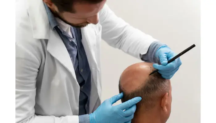 FUE Hair Transplant vs Other Methods: Which Is Better?
