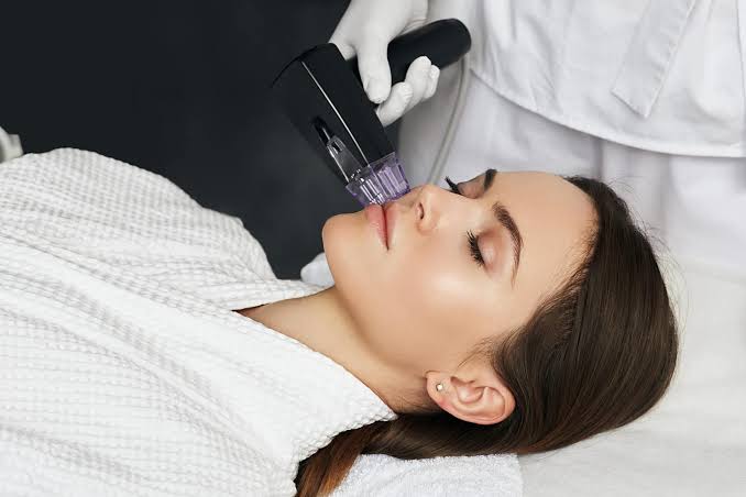 Morpheus8 Atlanta: What to Expect from This Skin Tightening Treatment in 2026